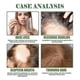 thumbnail image 4 of 3X Rosemary Mint Scalp & Hair Strengthening Oil With Biotin & Essential Oils, Nourishing Treatment, 4 of 5