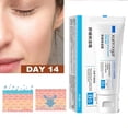 thumbnail image 2 of Crema de reparación de rojeces faciales, reparación de 7 días, reparación de Rosacea de la piel roja, mejora la piel sensible, cuidado cosmético coreano, 2 of 5