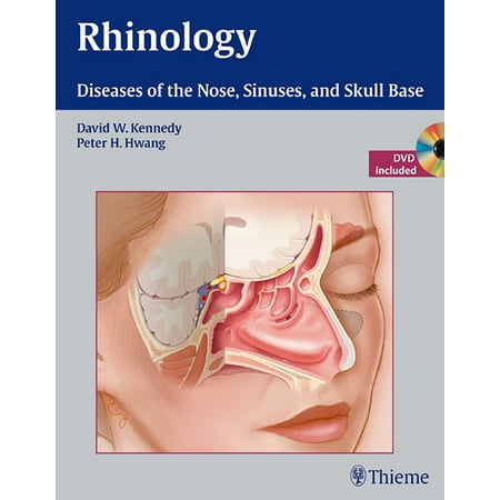 UPC: 9781604060607 | Rhinology: Diseases of the Nose  Sinuses  and Skull Base (Hardcover)