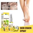 thumbnail image 1 of Foot Care Foot Spray Anti-drying and Moisturizing Banana Coconut Foot Care Spray for Dry and Rough Skin, 1 of 9
