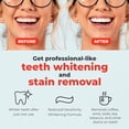 thumbnail image 2 of Zimba Tiras Blanqueadoras De Dientes Con Sabor A Menta Esmalte Vegano Blanqueador De Dientes Con Peróxido De Hidrógeno Seguro Para Café Vino Tabaco Y Otras Manchas Tratamiento De 14 Días Menta, 2 of 5