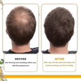 thumbnail image 4 of Biotin Dense Hair Series Deep Cleansing And Moisturizing Scalp Anti-Drop Solid Hair Dense Hair Care Shampoo Series, 4 of 5