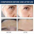 thumbnail image 4 of Jaysuing Anti-wrinkle Serum Facial Fades Fine Lines Around The Eyes, Nasolabial Folds, Wrinkles Massage Firming Anti-aging Anti-aging Skin Care Kit -G, 4 of 5