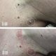 thumbnail image 5 of Pluma de aceite esencial para eliminación de verrugas de 3ml, removedor de marcas en la piel, producto de belleza para el cuidado de la piel Ygjytge Cuidado Belleza, 5 of 7