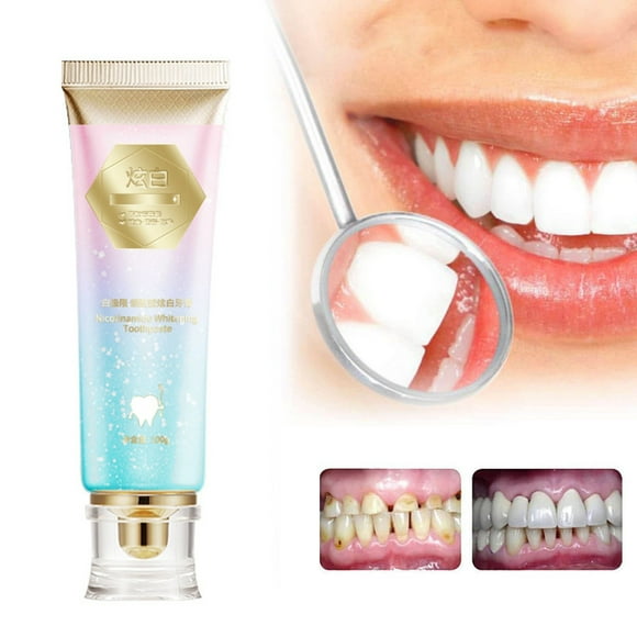 Fiudx Pasta de Dientes Aliento Fresco, Fórmula Antimanchas Intensiva, Ingredientes Naturales para Dientes Más Blanqueados, Espuma Suave para La Protección de Encías, Cuidado Bucal Diario, Adultos y A
