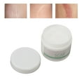 thumbnail image 4 of Crema Hidratante Para Cicatrices, Crema Para Eliminar Cicatrices, Sin Irritación, Reduce Las Arrugas, Masaje, Absorbe Para Cicatrices Quirúrgicas, 4 of 7