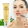 acne-cream-clearasil-stubborn-acne-control-5-in-1-spot-treatment