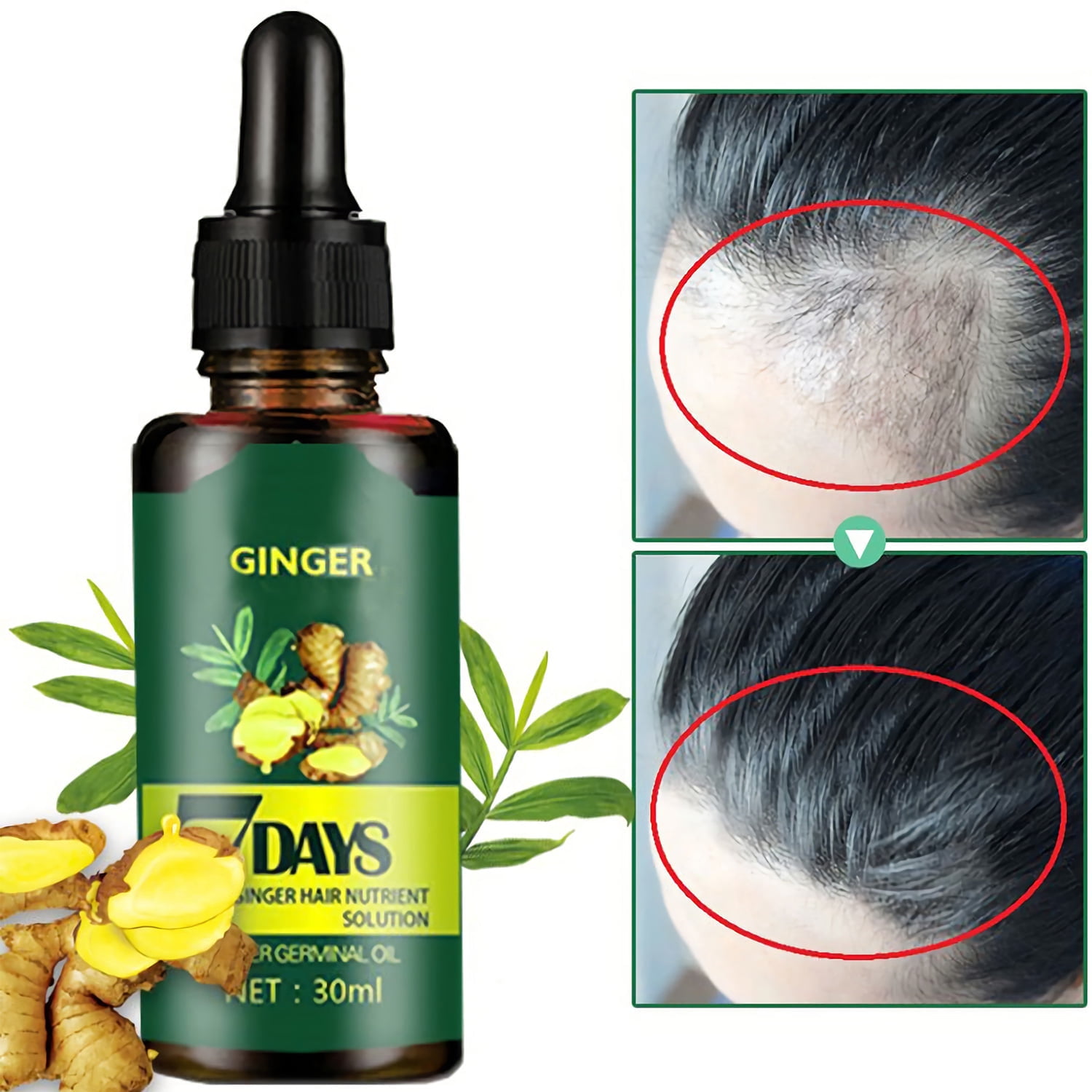 Regrow Ginger Germinal Hair Growth Serum Hairdressing Oil Loss Treatment -  2022 Upgrade 
