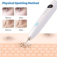 thumbnail image 4 of Lápiz láser LCD para eliminación de tatuajes, herramienta Profesional para el cuidado de la piel, pecas, verrugas, manchas oscuras, Belleza, 4 of 4
