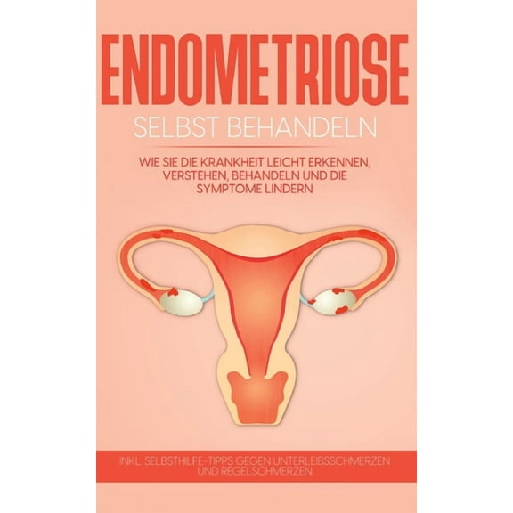 Endometriose selbst behandeln: Wie Sie die Krankheit leicht erkennen, verstehen, behandeln und die Symptome lindern - in, (Paperback)