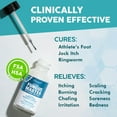 thumbnail image 2 of Ebanel Athletes Foot Fungus Treatment Extra Strength with Miconazole, Undecylenic Acid, Tea Tree Oil, Herbal Remedies, Antifungal Cream for Skin to Kill Fungi Lead to Nail Fungus, Ringworm, Jock Itch, 2 of 5