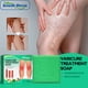 thumbnail image 4 of Jumpingount Eliminador de varices de extracción Natural, de viaje, circulación sanguínea, herramienta de eliminación de venas varicosas, Protección de la piel, 4 of 6
