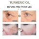 thumbnail image 4 of 30ml Turmeric Oil Pure Natural Pleasant Moisturizing Anti-aging Serum Lighten. -, 4 of 5