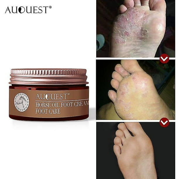 Foot heel hotsell repair cream