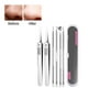 thumbnail image 5 of Xihbxyly Kit de Eliminación de Puntos Negros, Extractores Profesionales de Acero Inoxidable, Mango Antideslizante, Estuche Portátil, Rutina de Cuidado de La Piel, Artículos Esenciales de Belleza para, 5 of 6