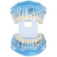 thumbnail image 5 of Modelo De Simulación De Dientes Dentales, Modelo De Dientes Livianos Para Demostración De Investigación De Patología Ccdes Otros, 5 of 8