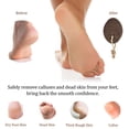 thumbnail image 4 of Pumice Stone Feet Callus Remover,Lava Foot Pumice Stone for Callous Warts Dead Skin Removal,Natural Exfoliating Stone-Brown, 4 of 5