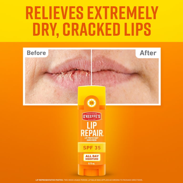 Lip Repair SPF 35 Balm Sticks with Aloe, Pack of 3 photo 2