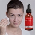 thumbnail image 3 of Serum Facial para Piel Grasa, Anti Acné, Elimina Manchas Y Cicatrices 20ml FORMULABS Grasa, 3 of 7