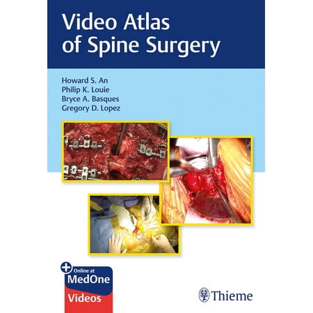 UPC: 9781684200054 | Video Atlas of Spine Surgery (Hardcover)
