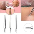 thumbnail image 5 of 5Pcs Stainless Facial Acne Spot Pimple Remover Extractor Tool Comedone, 5 of 5