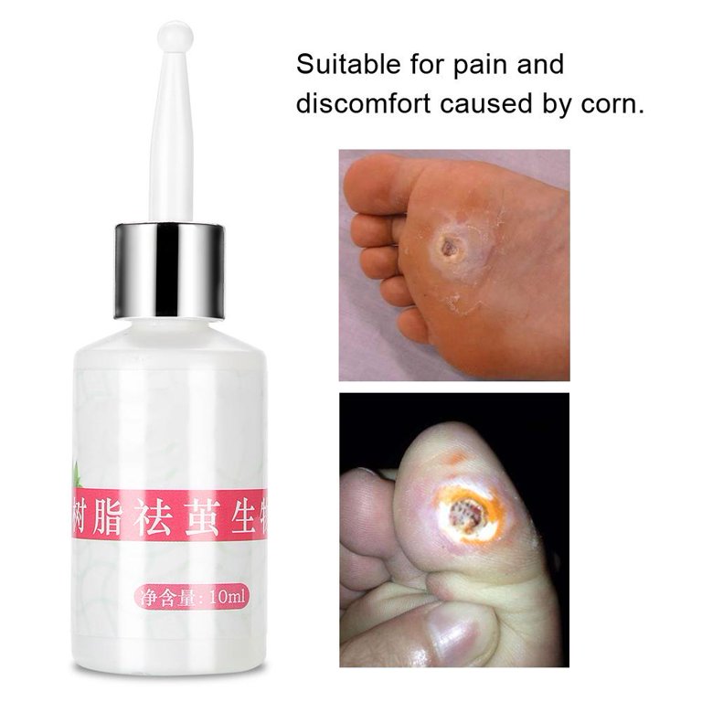 Corn Remover Cream,10ml Foot Toes Corn Callus Removal Cream Pad