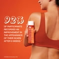 thumbnail image 4 of Bio-Oil Skincare Body Oil for Scars and Stretch Marks, Serum Hydrates Skin, 2 fl oz, 4 of 10