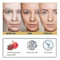 thumbnail image 4 of Golden Age Refining Serum Anti-aging Daily Serum With Pomegranate Extract Sodium Hyaluronate Erase Deep Wirnkles An, 4 of 5