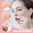 thumbnail image 4 of Parches para espinillas, puntos de parche para zit facial, pegatinas para cubrir imperfecciones, parche absorbente para acné, parche invisible para manchas hidrocoloides, impermeable y trans, 4 of 5