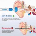 thumbnail image 2 of Oroclear Earwax Remover, Electric Ear Cleaner, Oroclear Ear Wax suction remover, 2 of 5