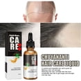 thumbnail image 4 of Aceite de Biotina para El Crecimiento Del Cabello | Nutre El Cuero Cabelludo | Promueve Un Crecimiento Rápido | Cuidado Capilar Anticaída | Botella de 30 Ml, 4 of 7