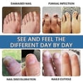 thumbnail image 5 of Extra Strong Fungal Nail Treatment - Effective Solution For Finger & Toenail Fungus, Protects Thick, Broken, Discolored Nails, Restores Discolored Nai, 5 of 5