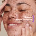 thumbnail image 4 of UIQ Biome Remedy Crema calmante Calmante instantáneo Pantenol hidratante no comedogénico Hidratante facial diario Cuidado de la piel coreano 1.69 fl. onz. (50ml), 4 of 5