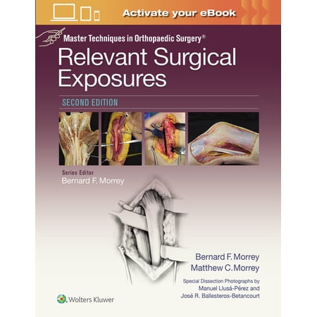 Master Techniques in Orthopaedic Surgery Master Techniques in Orthopaedic Surgery: Relevant Surgical Exposures (Hardcover)