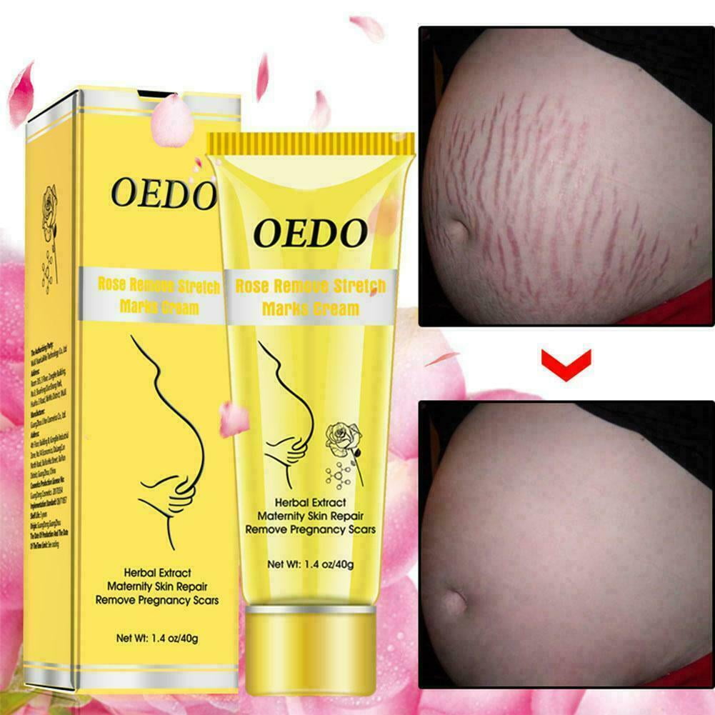oedo stretch mark cream price