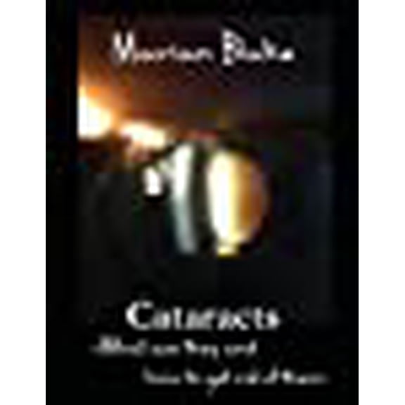 Cataracts: What are they and how to get rid of them? (Your Eyes) (Volume 2)