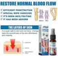 thumbnail image 5 of Varicose Vein Massage Spray for South Moon - Say Goodbye to Leg Discomfort, 5 of 5