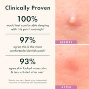 Rael Beauty, Miracle Blemish Patch Overnight Spot Cover, 26 Count