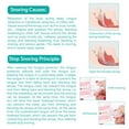 thumbnail image 4 of GENKENT 2 Pcs Anti Snoring Tongue Device with Storage Case, Silicone Tongue Sleeve for Sleep Apnea Aid Stop for Adult, Colorless, 4 of 8