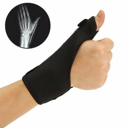 Cloth Medical Wrist Thumb Hand Spica Splint Support Brace Stabiliser Sprain Arthritis,Ideal for healing carpal tunnel syndrome, wrist fractures, sprains, ligament , tendon (Best Shoes For Tarsal Tunnel Syndrome)