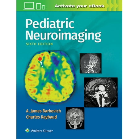 UPC: 9781496337207 | Pediatric Neuroimaging (Hardcover)