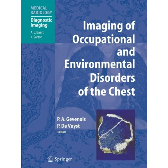Imaging of Occupational and Environmental Disorders of the Chest, (Paperback)