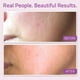 thumbnail image 4 of Sérum facial YEOUTH antienvejecimiento con ácido hialurónico, vitamina C y E, 4 of 8