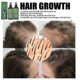 thumbnail image 2 of 2pcs Hair Growth Treatment Spray Anti Ha, 2 of 5