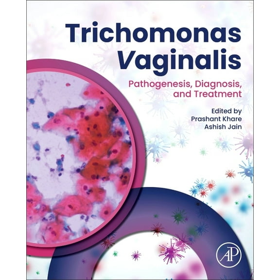 Trichomonas Vaginalis: Pathogenesis, Diagnosis, and Treatment, (Paperback)