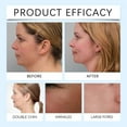 thumbnail image 4 of Chin Lifting Mask - Double Chin Reducer, Jawline Firming Mask for Face and Neck, Anti-Aging Skincare Treatment, Say Goodbye to Your Double Chin Now, 4 of 9