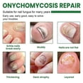 thumbnail image 5 of 2X 2024 New Essential Oil Nail Fungus Repair Liquid Nail Thickening Discoloration Off Soft Nail Thickening Type Onychomyc 20ml, 5 of 5