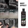 thumbnail image 2 of Anti-Dandruff Shampoo,Shampoo for Scalp Prone to Folliculitis, Dermatitis, Dandruff, Itchy and Flaky Scalp -440206975001, 2 of 4