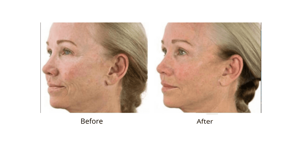 Dr. Sevinor’s NEW Genuine Facelift Solution Concentrated Serum Jumpstarts Tired Looking Skin, Diminishes Wrinkles/Lines Renews Skins Elasticity