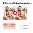thumbnail image 4 of 2% BHA Skin Liquid, BHA Skin Liquid Exfoliant For Face, Facial Exfoliator Serum Improves Skin Texture, 4 of 4